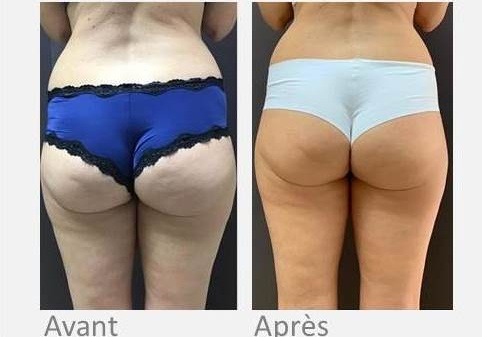 OndaDinamica fesse