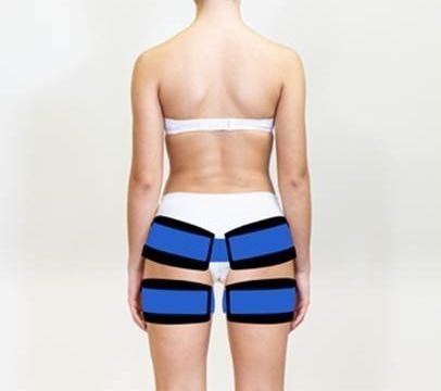 X-Tone Dimagrelle - électrostimulation - fesse