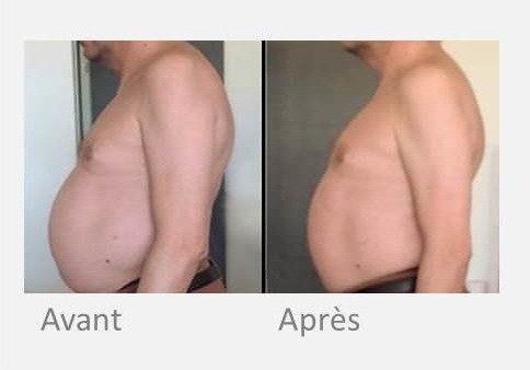X-magic ventre homme